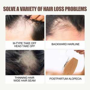 OEM West <span class=keywords><strong>Month</strong></span> <span class=keywords><strong>Hair</strong></span> Root <span class=keywords><strong>Growth</strong></span> Anti Dropping Masaje de cabello firme Tratamientos de crecimiento de cabello denso del cuero cabelludo - Product Image 3