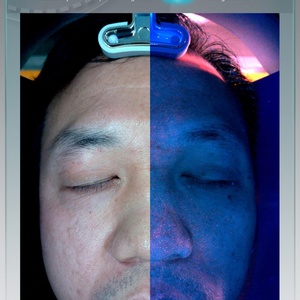 Escáner Facial 3D con Tecnología IA 2025, Analizador de Piel para Centro de Estética con Tipos de Enchufes para EE. UU., IT, JP y ZA - Product Image 6