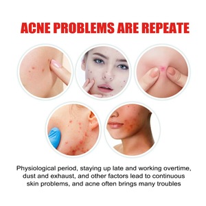 Patchs anti-acné 40 étoiles les plus vendus pour couvrir les imperfections et les boutons du visage - Product Image 3