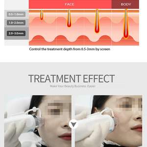 Microaghi per Risolvere Problemi Facciali, Laser a Diodi 980nm per Vene Varicose e Capillari, Macchina di Bellezza RF con Microaghi - Product Image 5