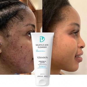 OEM ODM producto <span class=keywords><strong>ácido</strong></span> <span class=keywords><strong>salicílico</strong></span> lavado de cara antiacné crema blanqueadora loción <span class=keywords><strong>limpiador</strong></span> de poros espuma cuidado de la piel Gel <span class=keywords><strong>limpiador</strong></span> Facial Gel - Product Image 2