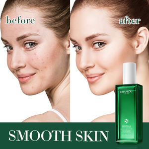 OEM coreano Etiqueta Privada FAYANKOU Centella Asiatica calmante hidratante tóner hidratante <span class=keywords><strong>astringente</strong></span> para todo tipo de <span class=keywords><strong>piel</strong></span> - Product Image 5