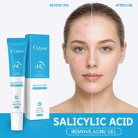 Crème Réparatrice Rapide et Efficace pour Cicatrices d'Acné à l'Acide Salicylique – Anti-Taches, Resserre les Pores, Lisse la Peau