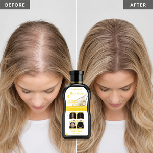 Shampooing Naturel Bio pour la Croissance des <span class=keywords><strong>Cheveux</strong></span>, Hommes et Femmes, Anti-<span class=keywords><strong>Chute</strong></span>, Stimulant la Repousse des <span class=keywords><strong>Cheveux</strong></span>, Vente Chaude - Product Image 1