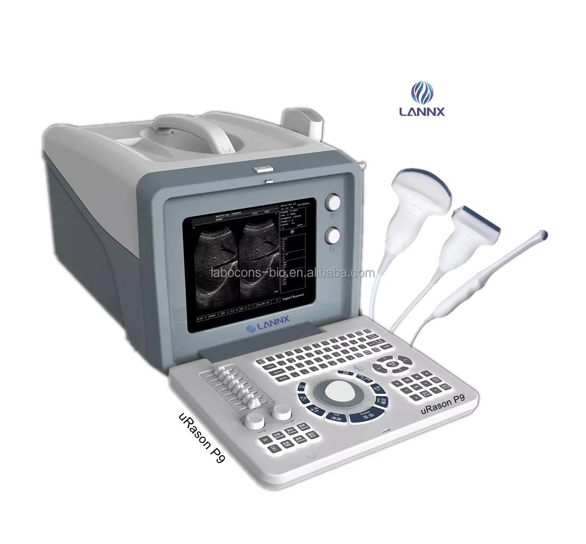 LANNX uRason P9 Fully stocked Echography laptop black/white digital instruments ultrasound portable ultrasonic diagnostic device
