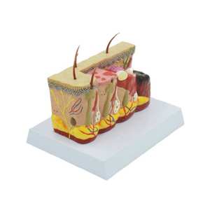 Modèle stéréoscopique 3D de la peau brûlée, modèle médical de la structure de la peau humaine, modèle d'enseignement des blessures, comparaison des brûlures pour l'éducation médicale CE/ISO - Product Image 4