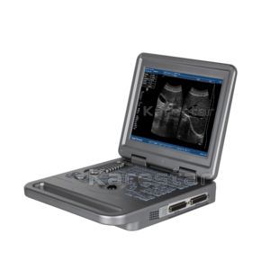 Ecógrafo Portátil Digital Completo en Blanco y Negro para Uso Veterinario - Product Image 4