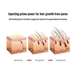 Fast Delivery Biotin Nourishing Anti <b>hair</b> <b>Loss</b> <b>Hair</b> Growth Moisturizing Scalp Care Serum - Product Image 4