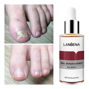Sérum réparateur pour ongles LANBENA, soin des pieds, liquide fortifiant pour ongles abîmés - Product Image 3