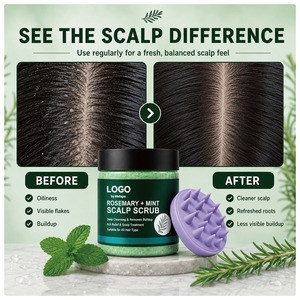 <span class=keywords><strong>Shampoo</strong></span> Scrub per il Cuoio Capelluto al Rosmarino e Menta, Pulizia Profonda, Esfoliante, Controllo dell'Oleosità, Rinfrescante, Idratante, Lisciante, Cura dei Capelli - Product Image 5