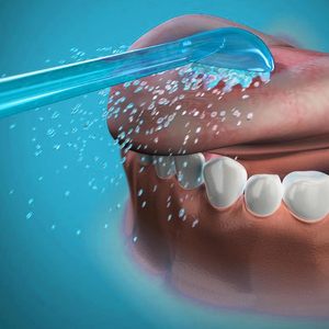 Puntas de Repuesto para Irrigador Bucal, Puntas Clásicas de Chorro, Juego de 8 Piezas de Plástico - Product Image 3