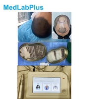 Machine d'implantation capillaire Sa Ekimi Fue, machine d'extraction par punch portable 10000 tr/min multi-tailles 0,6-1,2 mm pour cheveux longs/lisses