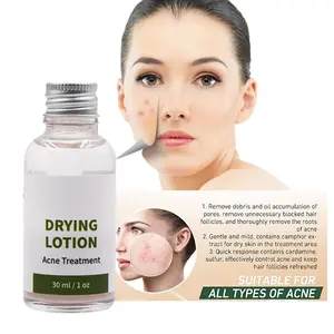 Produttore OEM ODM brufolo rimozione Anti Acne Spot Treatment siero Clear Face Body Drying Lotion per uomini e donne