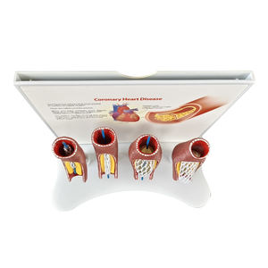 Vaso sanguigno malato modello SMM319 - Product Image 3