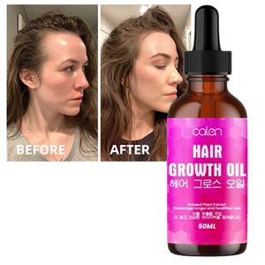 Luxfume 50ML Venta al por mayor Original planta nutritiva crecimiento del cabello para picazón y cuero cabelludo seco aceite para el cuidado del cabello - Product Image 1