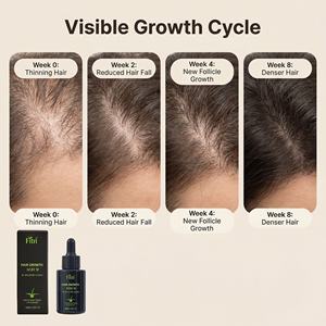 โลชั่นบำรุงผมสมุนไพรธรรมชาติสำหรับผู้ทานมังสวิรัติ ผลิตตามความต้องการของผู้ผลิต บำรุงหนังศีรษะ ฟื้นฟูเส้นผม เซรั่มบำรุงรากผม 2-in-1 - Product Image 4