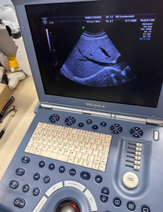 Fourniture et réparation de la machine à ultrasons portable Voluson e VolusonE Voluson.e - Product Image 4