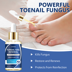 Tùy chỉnh nấm móng tay đổi mới tối đa sức mạnh undecylenic 25%, giết chết nấm, phục hồi và làm mới, bảo vệ khỏi tái nhiễm - Product Image 3