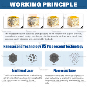 Xách tay 532nm 755nm 1064nm 1320nm Pico thứ hai Laser loại bỏ hình xăm Máy Nd Yag Q Switched Pico Laser loại bỏ hình xăm - Product Image 6