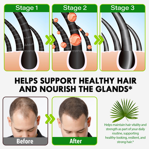 Acentiallabs toptan doğal testere <span class=keywords><strong>Palmetto</strong></span> özü takviyesi testere <span class=keywords><strong>Palmetto</strong></span> kapsüller için erkek prostat sağlık desteği - Product Image 4