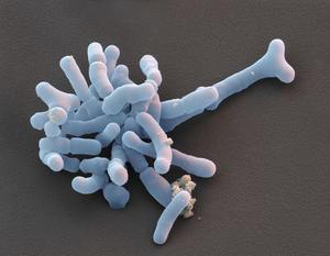 בעלי חיים ביפידובקטריום לקטובצילוס פרוביוטיקה 10 מיליארד חיידקים חומצה לקטית מיובשת בהקפאה אבקת משקה מוצק - Product Image 3