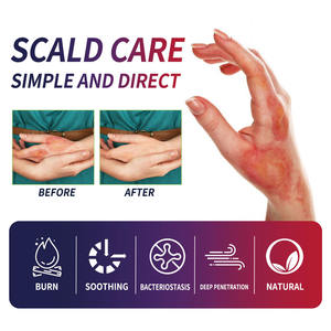 Crème de soin des brûlures South Moon 20g en gros, absorption rapide, soulage la douleur et la sensation de brûlure, sans odeur irritante - Product Image 3