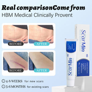 Gel de silicone médical puissant et efficace pour les cicatrices d'acné et les vergetures - Cible le corps, le visage, les lèvres, les jambes/bras - Élimination des cicatrices - Product Image 5