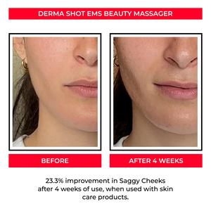 NUEVO Masajeador Facial Eléctrico R, Producto Patentado, Herramienta de Masaje Facial Eléctrico Recargable con Microcorriente - Product Image 4