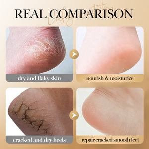 Vente chaude crème hydratante <span class=keywords><strong>pour</strong></span> <span class=keywords><strong>les</strong></span> <span class=keywords><strong>pieds</strong></span> à <span class=keywords><strong>base</strong></span> de collagène élimination et réparation de la peau morte <span class=keywords><strong>pour</strong></span> <span class=keywords><strong>les</strong></span> <span class=keywords><strong>pieds</strong></span> secs fissurés soins de la peau lisse - Product Image 6