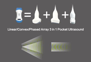 Sonda de Ultrasonido Doppler a Color Inalámbrica Portátil 3 en 1 Compatible, Mini, de Mano, para Uso Humano, Instrumento Médico - Product Image 6