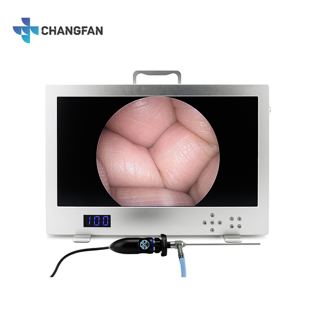 Endoscopic Video Camera System 24 Inch All in One Portable Full HD 1080p Medical Endoscope Camera System for Hospital