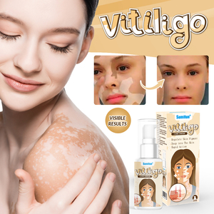 Crème Pommade Soulageant les Taches Blanches pour le Corps Traitement aux Plantes pour la Peau Crème pour le <span class=keywords><strong>Vitiligo</strong></span> Plâtre Chinois Ciblé pour l'Élimination des Taches - Product Image 4