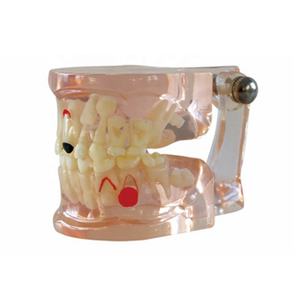 Modelo dental claro de dientes de edad mixta con caries - Product Image 2