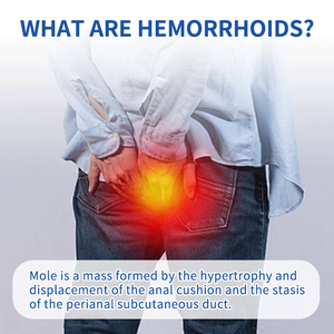 Crema bacteriostática chinesa de venta caliente para hemorroides: alivia el dolor, la sangre <span class=keywords><strong>en</strong></span> el ano, la hinchazón y las fisuras anales, Clase I - Product Image 6