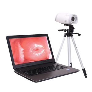 स्त्री रोग विज्ञान योनि परीक्षा के लिए सस्ते डिजिटल पोर्टेबल वीडियो कोलोपोस्कोप कैमरा - Product Image 5