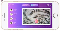 Analyseur de cuir chevelu sans fil AI WIFI portable avec zoom 50X-200X pour salon de beauté et détection des follicules pileux à domicile