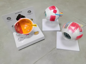 Modelo Anatómico Educativo de Ojo Humano con Cataratas, 6 Partes, 3D, Plástico, para Enseñanza de Ciencias Médicas - Product Image 5