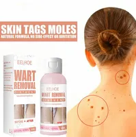 Effective Flat Warts Remover Cream, Skin Mole, Dark Spot