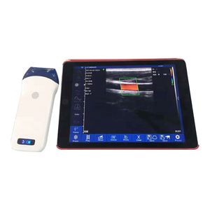 Sonde d'échographie couleur sans fil CProbe-5L, scanner à ultrasons linéaire, sondes <span class=keywords><strong>USG</strong></span> portables pour smartphone - Product Image 6