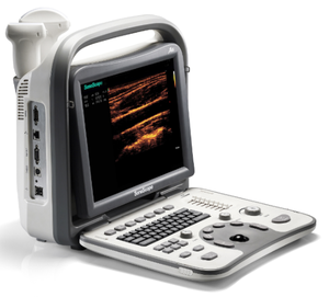 <span class=keywords><strong>Sonoscape</strong></span> <span class=keywords><strong>A5V</strong></span> B/W Portable Veterinary <span class=keywords><strong>Ultrasound</strong></span> Mesin - Product Image 5