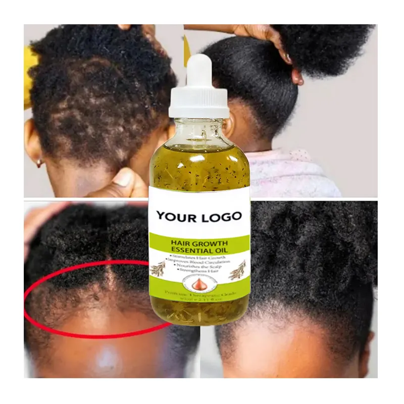 Private Label Strenthening Repair hair growth treatment oil Nourishing Hair Regrowth Oil Rosemary Batana Castor Oil