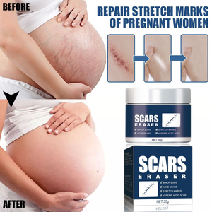 Nhãn Hiệu Riêng Hữu Cơ Kem Cơ Thể Cho Nhanh Chóng Cứu Trợ Và Sửa Chữa Các Vết Sẹo Cũ Hiệu Quả Trên Sẹo Vết Rạn Rạn Và Bỏng - Product Image 4