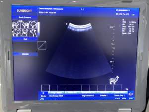 La machine portative d'ultrason de vétérinaire noir et blanc 15 pouces a mené le système d'imagerie diagnostique d'<span class=keywords><strong>Usg</strong></span> - Product Image 4
