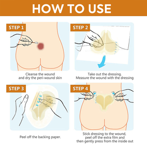 แผ่นแปะแผลไฮโดรคอลลอยด์หนาพิเศษรูปหัวใจขนาดใหญ่ - Product Image 6