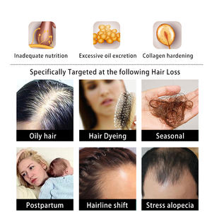 İlaçlı saç büyüme şampuanı kaybı kore - Product Image 4