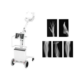 Appareil de radiographie portable à écran tactile IN-8KW de 10,4 pouces, 8 kW, pour <span class=keywords><strong>clinique</strong></span> et <span class=keywords><strong>radiologie</strong></span> - Product Image 2
