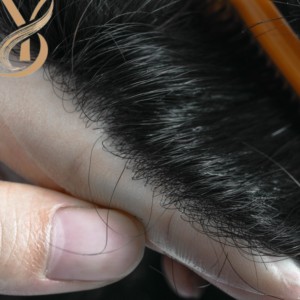 Sistema de Reemplazo Capilar Natural para Hombre con Ondas Naturales, Base de Encaje y PU, Cabello Remy Ligero, Diseño Central - Product Image 6
