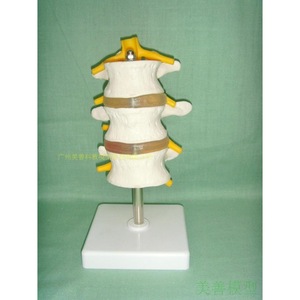 Modèle de colonne lombaire normale combiné ; Modèle de colonne lombaire en 3 sections ; Modèle de colonne lombaire en 3 sections ; Modèle de colonne lombaire en 4 sections - Product Image 1