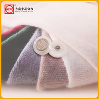 Boutons en plastique pour vêtements en gros, boutons classiques ronds à texture marbrée avec tige pour costumes