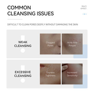 น้ำยาทำความสะอาด<span class=keywords><strong>ผิว</strong></span>หน้าให้ความชุ่มชื้น<span class=keywords><strong>สำหรับ</strong></span><span class=keywords><strong>ผิว</strong></span>บอบบาง - Product Image 4